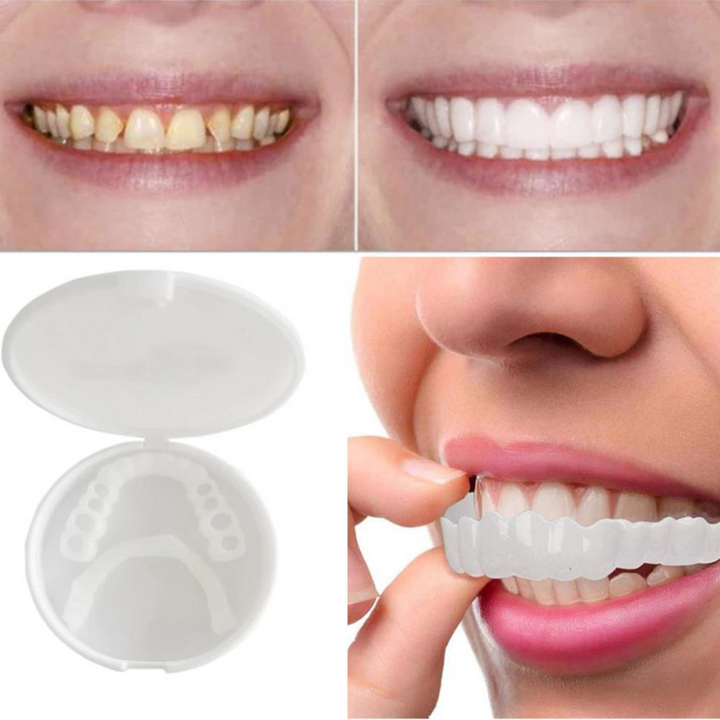 Optimaal Tandherstel met Luxe SmilePro